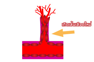 Angiogenesis (การสร้างเส้นเลือดใหม่) คืออะไร?_04
