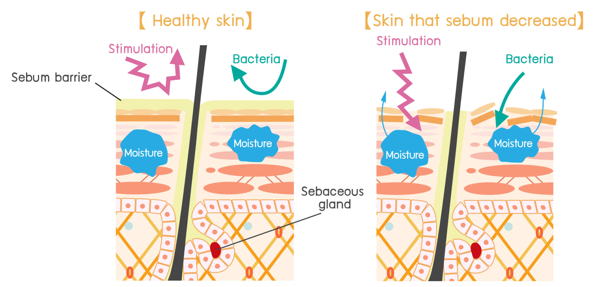 Insufficient sebum causes dry skin and cracks Heimat Vietnam